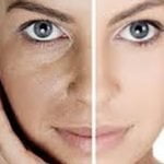 The Vampire Facial available at The Grove Skin Clinic, Swansea