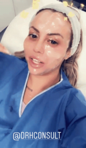 Holly Hagan prior to the CO2 Laser Facial 