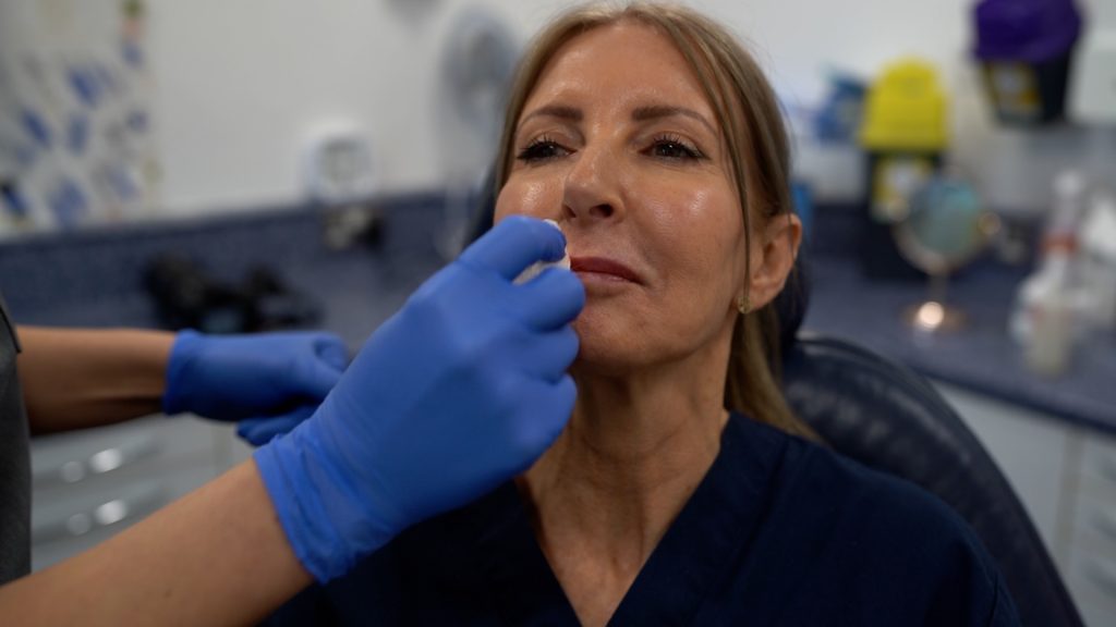 Facial Fillers - The Grove Skin & Laser Clinic