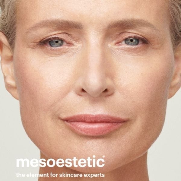 mesoestetic swansea